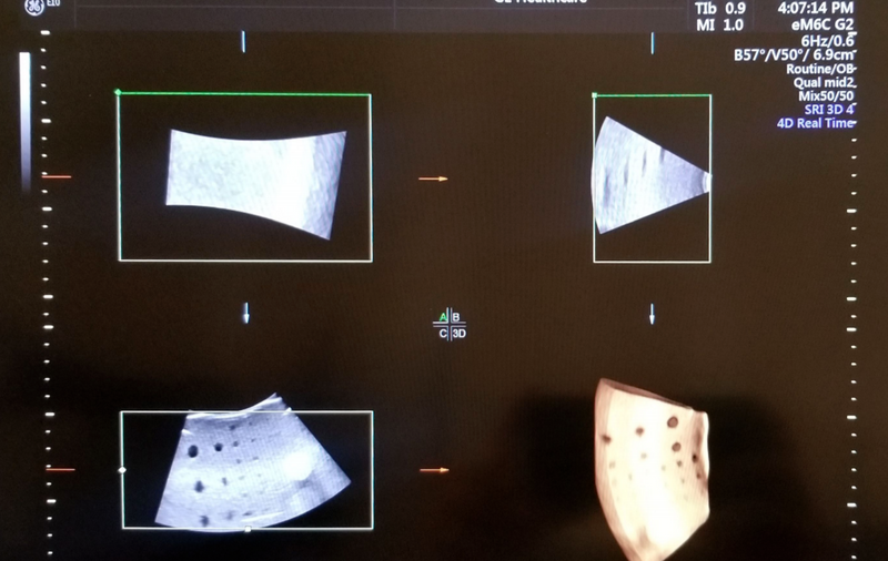 Load image into Gallery viewer, GE EM6c Gen 2 - 4D Matrix Transducer for Voluson E10 Screen