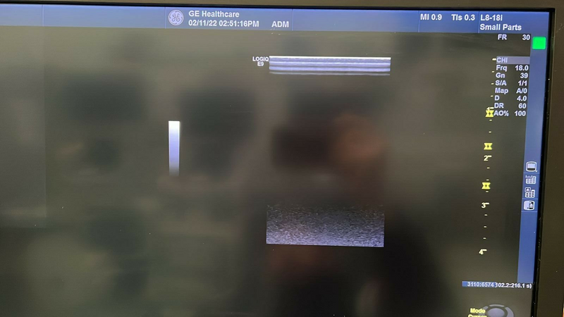 Load image into Gallery viewer, GE L8-18i-D Linear Hockey Ultrasound Transducer Screen