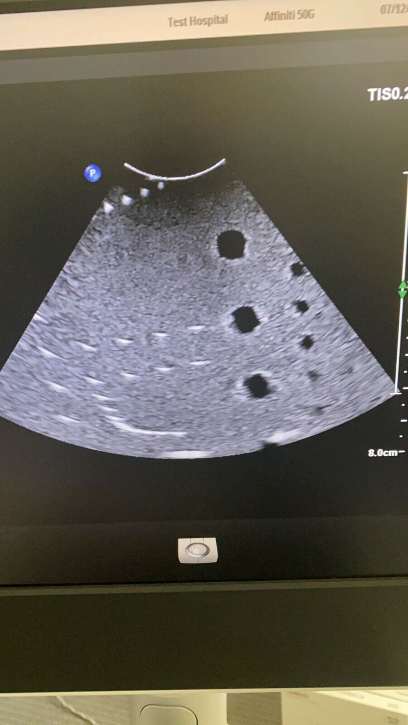 Load image into Gallery viewer, Philips CX MC7-2 Micro Convex Compact Transducer/Probe Screen