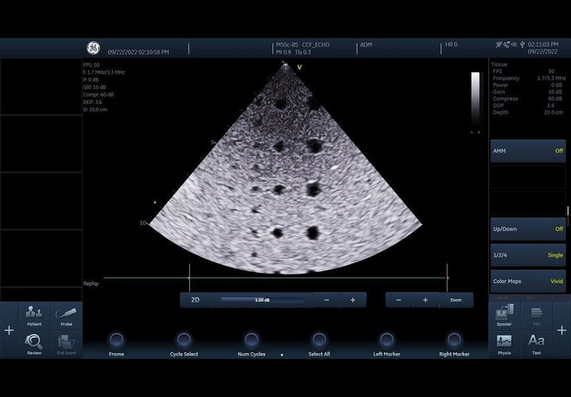 Load image into Gallery viewer, GE Vivid IQ Cardiac Premium Portable Ultrasound with M5Sc-Rs Screen