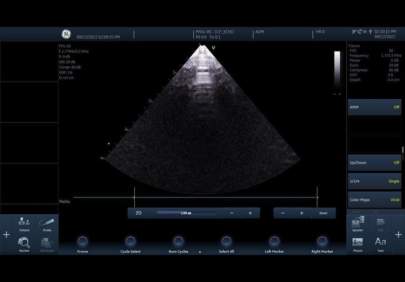 Load image into Gallery viewer, GE Vivid IQ Cardiac Premium Portable Ultrasound with M5Sc-Rs Screen