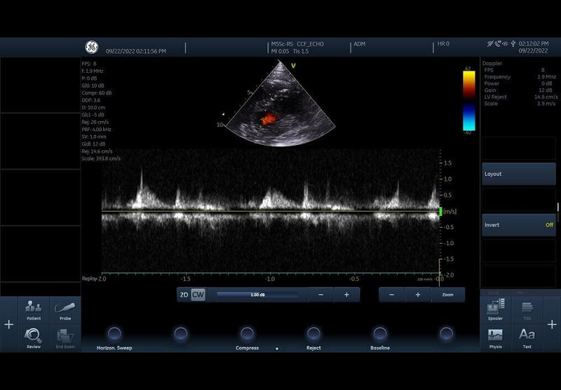 Load image into Gallery viewer, GE Vivid IQ Cardiac Premium Portable Ultrasound with M5Sc-Rs Screen