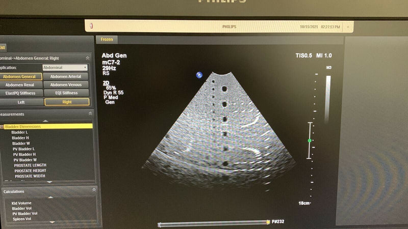 Load image into Gallery viewer, Philips CX MC7-2 Micro Convex Compact Transducer/Probe Screen