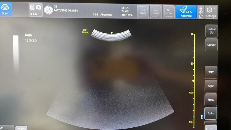 Load image into Gallery viewer, GE C1-5-RS Convex/Abdomen Ultrasound Transducer/Probe Screen
