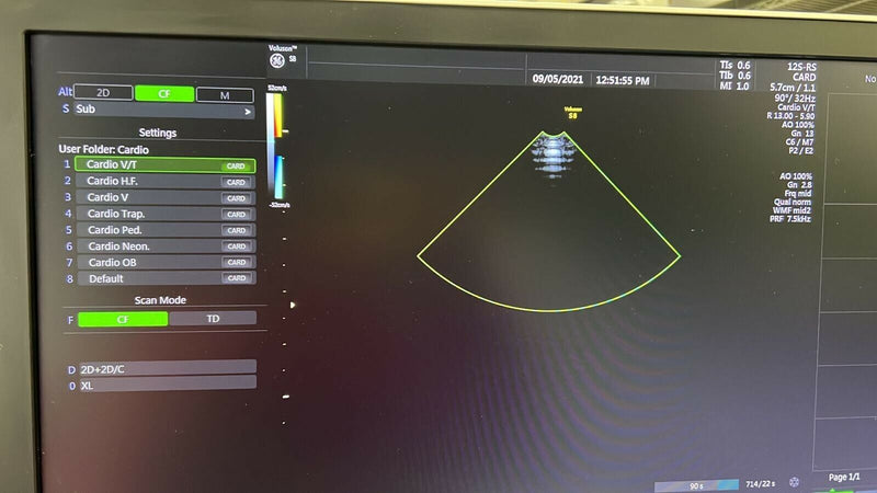 Load image into Gallery viewer, GE L4-12T-Rs Wide-band Linear Ultrasound Transducer/Probe Screen