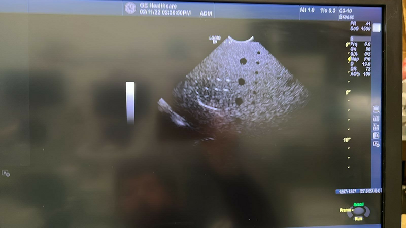 Load image into Gallery viewer, GE C3-10-D XDClear Microconvex Ultrasound Probe/Transducer Screen