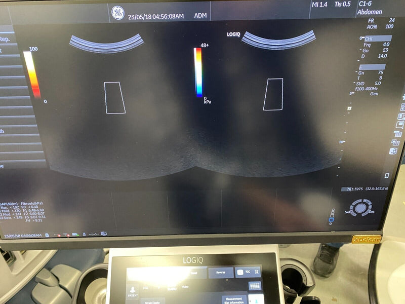 Load image into Gallery viewer, GE Logiq P10 R4 Cardiac & Shearwave Elastography Ultrasound System Screen