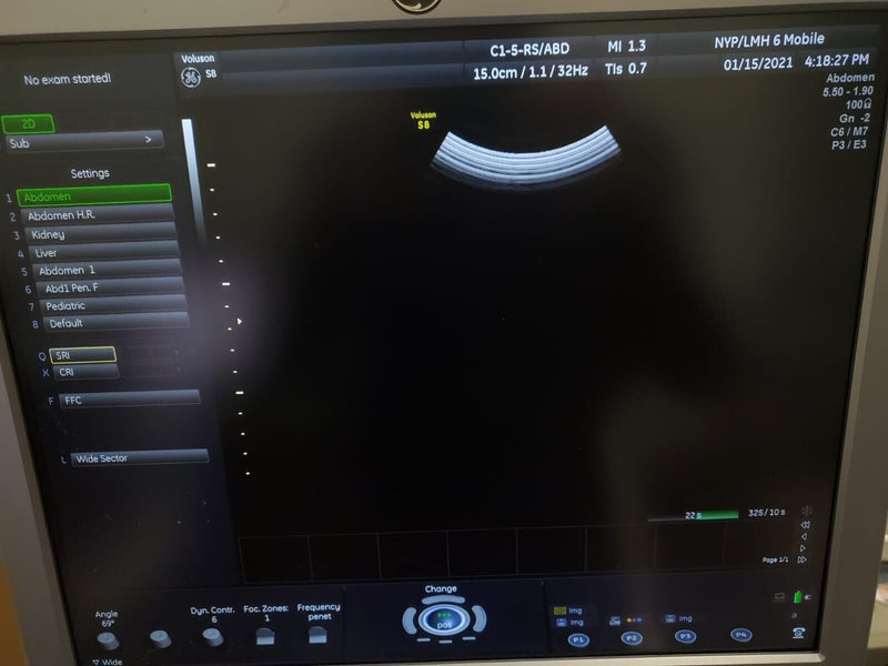 Load image into Gallery viewer, GE C1-5-RS Convex/Abdomen Ultrasound Transducer/Probe - Biomed Certified Screen