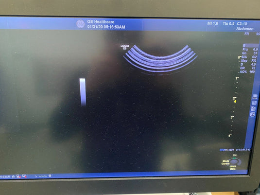 GE C3-10-D XDClear Microconvex Ultrasound Probe/Transducer Screen