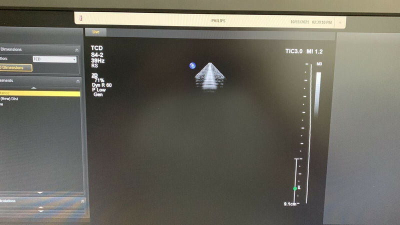 Load image into Gallery viewer, Philips CX S4-2 Adult Cardiac Compact Transducer/Probe Screen
