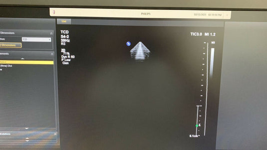 Philips CX S4-2 Adult Cardiac Compact Transducer/Probe Screen